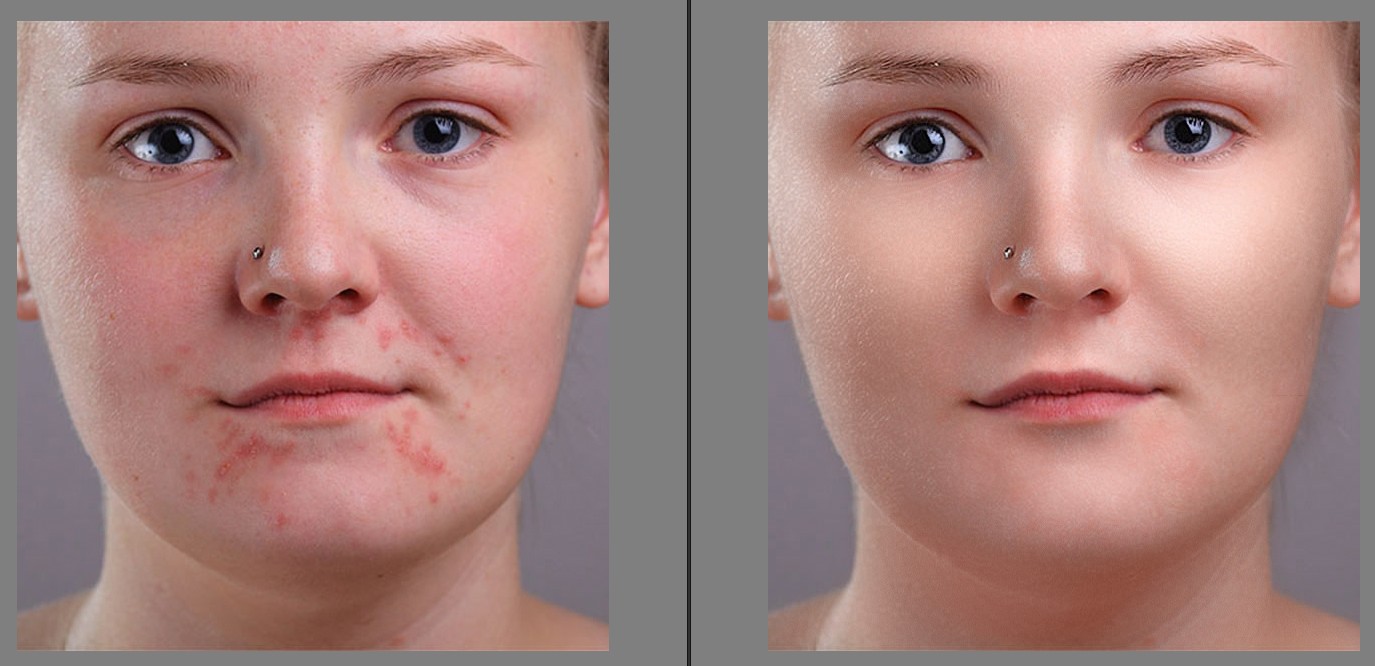آموزش حرفه ای ترین روشهای روتوش پوست و صورت و حذف جوش بدون زحمت در 4 دقیقه